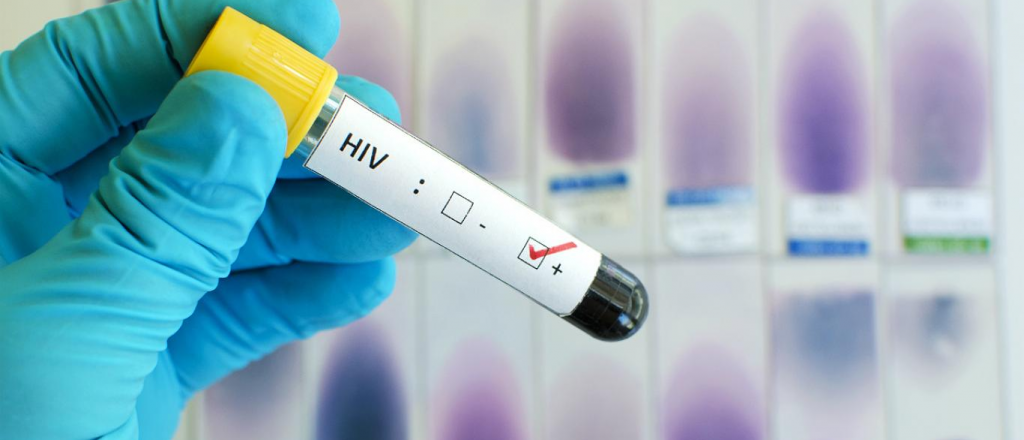 Argentina participará en una prueba para una vacuna preventiva del VIH   