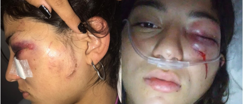 "No me importa ir preso, te voy a matar" le dijo a su novia de 16 y la desfigur&oacute;