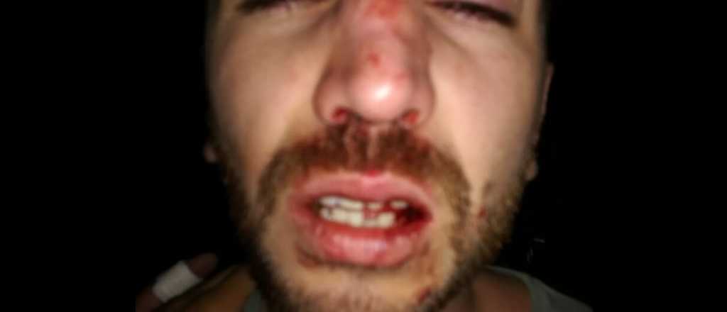 La madre del chico agredido en Grita Silencio: "Juan Cruz está muy dolido"