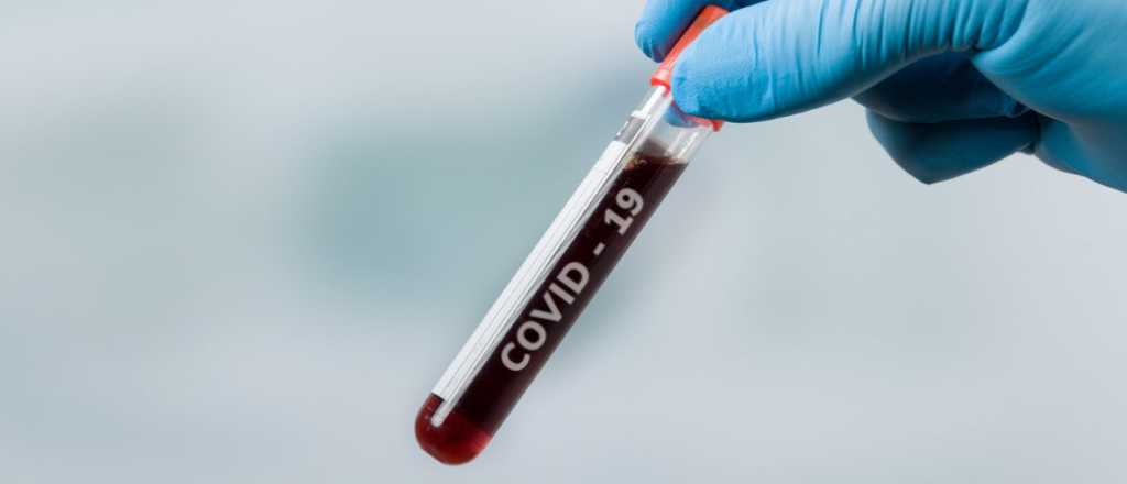 Mendoza está lista para analizar sospechas de coronavirus