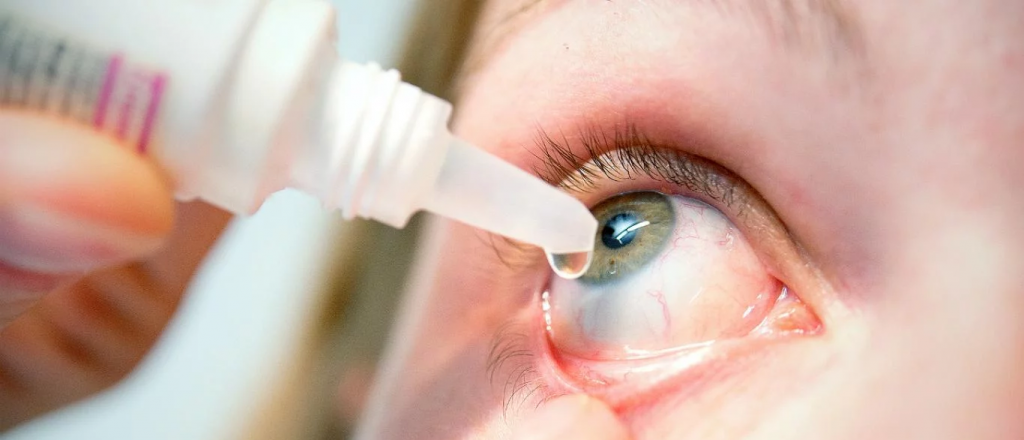 Dicen que la conjuntivitis puede ser un s&iacute;ntoma de coronavirus