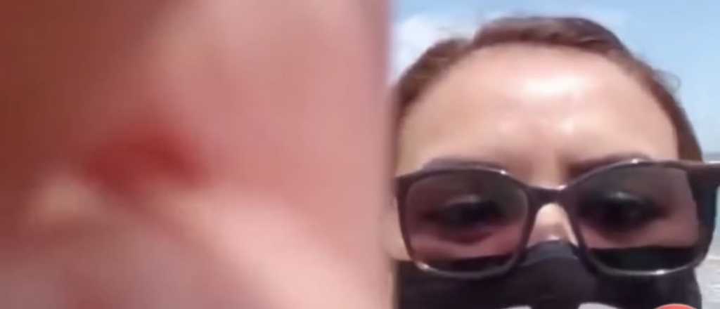 Una mujer fue agredida por filmar a turistas que violaron el aislamiento