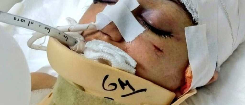 Su exmarido la dej&oacute; en coma, se recuper&oacute; y &eacute;l ahora podr&iacute;a quedar libre