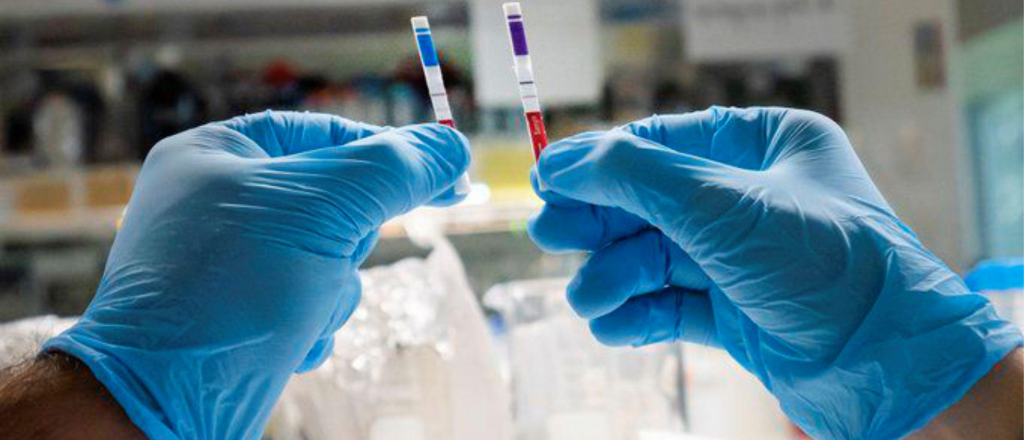 Cient&iacute;ficos argentinos dise&ntilde;aron un nuevo kit de diagn&oacute;stico r&aacute;pido