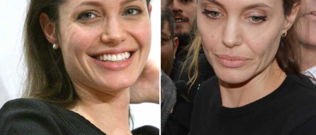 Los m&eacute;dicos a Angelina Jolie: "Come o morir&aacute;s"