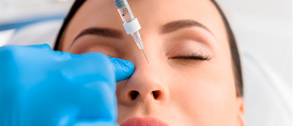 Rinomodelación: cómo corregir la nariz sin cirugía