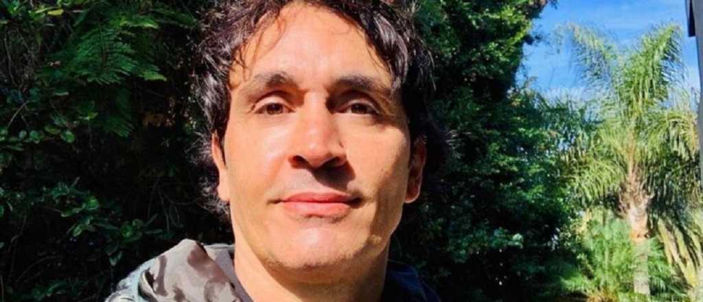 Sebasti&aacute;n Estevanez mostr&oacute; c&oacute;mo le qued&oacute; la cara tras quem&aacute;rsela