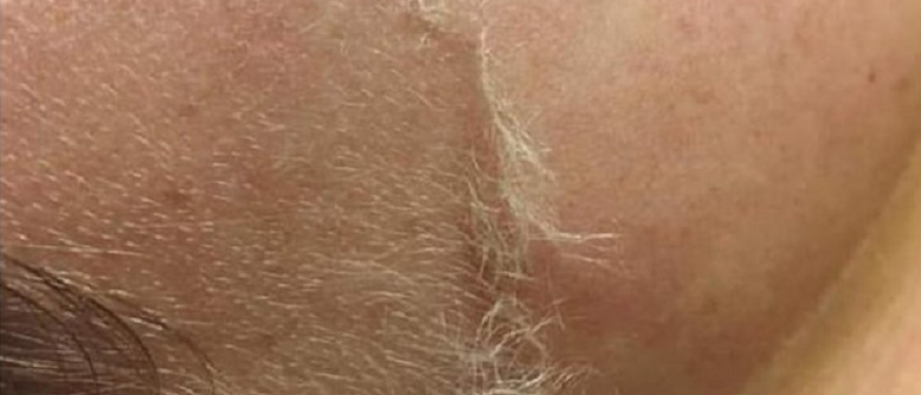 Tres cosas que ten&eacute;s que saber antes de hacerte Dermaplaning