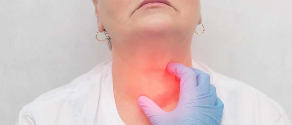El cáncer de tiroides es más frecuente, pero aseguran que no es letal