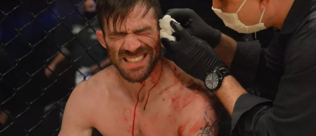 Video: a un luchador de MMA se le abrió la oreja por la mitad