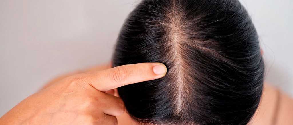 De dónde sacar las 6 vitaminas fundamentales para evitar la caída del pelo