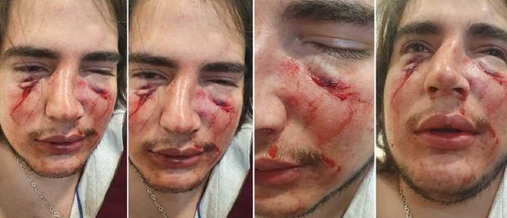 Tres rugbiers golpearon a un joven en un country de Córdoba