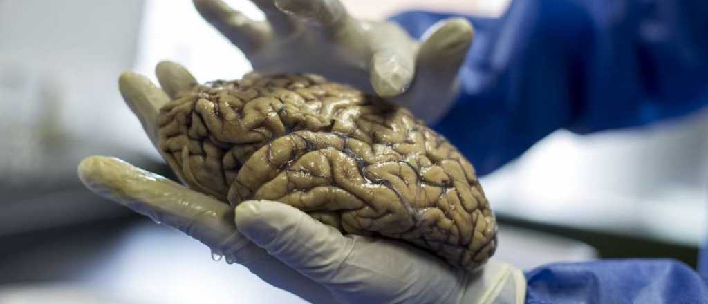 El Covid-19 podría aumentar el riesgo de desarrollar Alzheimer