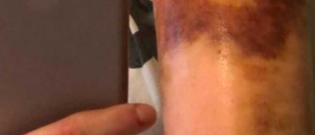 Las accidentadas y misteriosas fotos de Wanda Nara