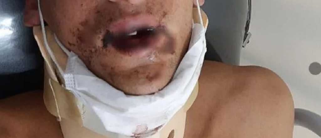 Un joven terminó en terapia intensiva por una pelea entre rugbiers