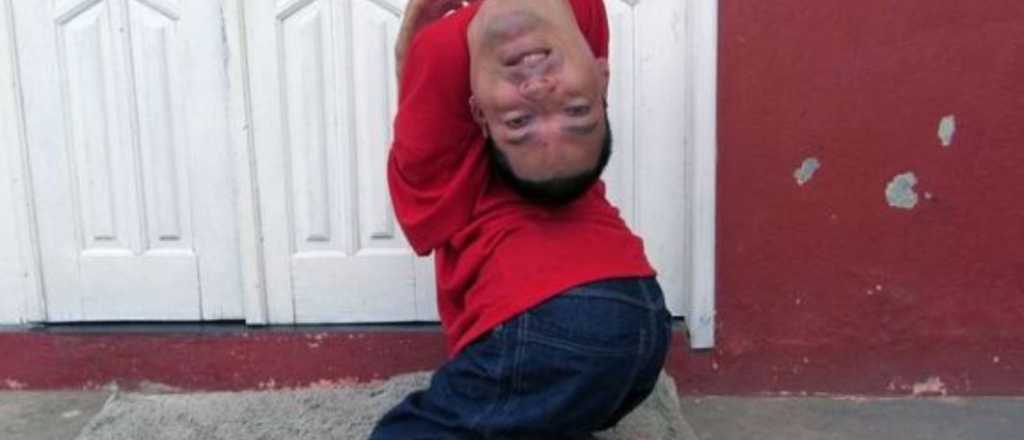 La historia del hombre que nació con la cabeza al revés