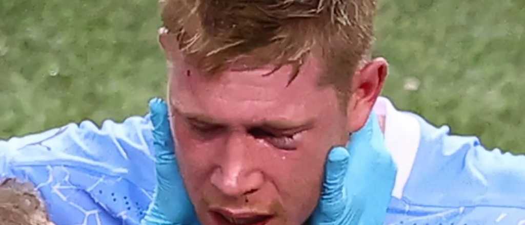 De Bruyne confirm&oacute; que tiene dos huesos de la cara rotos
