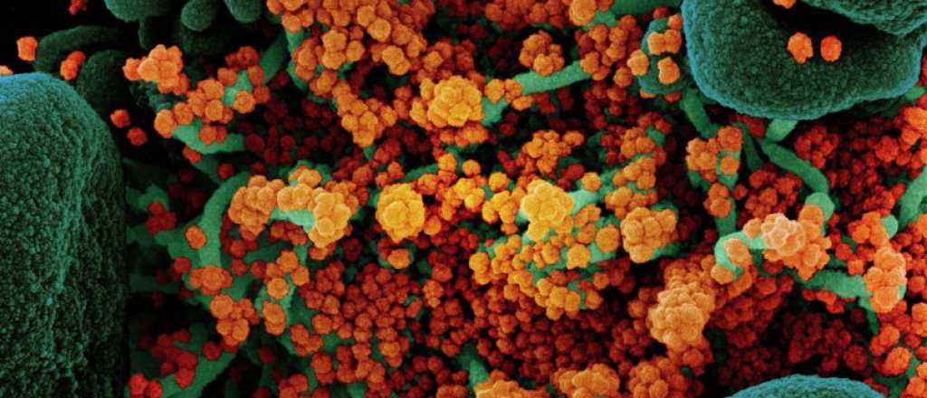 Detectan otra variante de covid m&aacute;s contagiosa: Epsilon