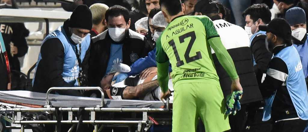 Preocupación en la Copa: le rompió la cara y lo mandó al hospital