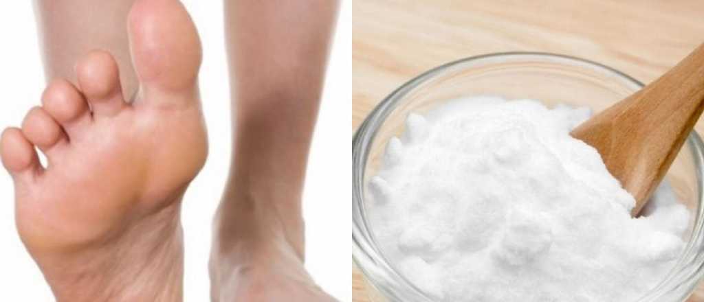 Así podes utilizar el bicarbonato para eliminar los hongos de los pies 