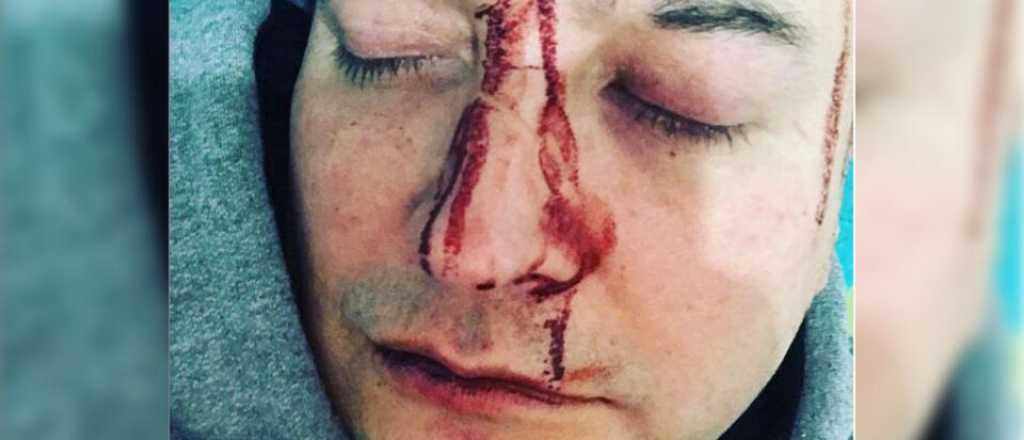 Video: el cantante Leo García sufrió un ataque homofóbico