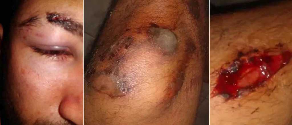 Video: brutal ataque de rugbiers a un joven en Tucuman