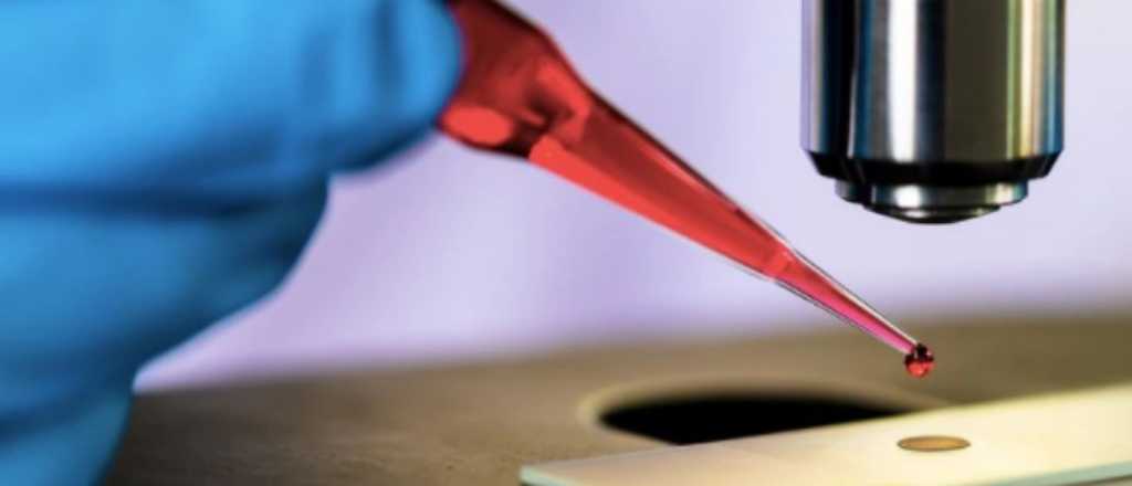 Logran eliminar el cromosoma causante del Síndrome de Down