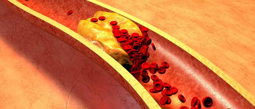 Cuál es el fruto que reduce el colesterol