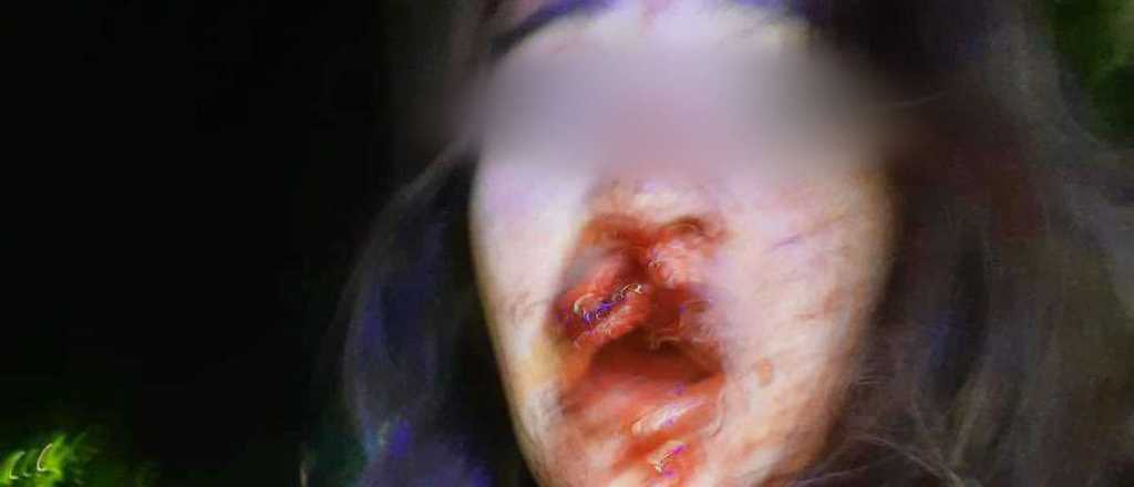 Una joven denunció que fue golpeada por policías en Córdoba