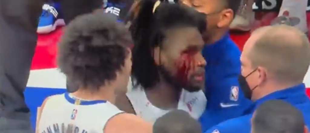 Video: codazo de LeBron, sangre y papel&oacute;n en la NBA