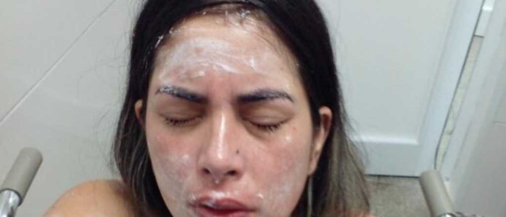 Una mujer persigui&oacute; y roci&oacute; con gas pimienta a otra porque la choc&oacute;