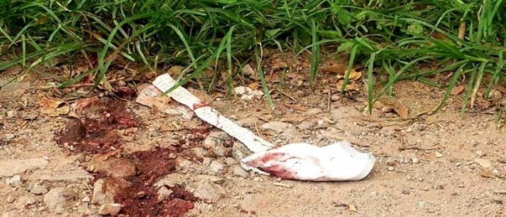 Confundió a su hijo con un ladrón y le disparó en la cabeza