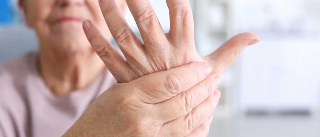 Cómo aliviar la inflamación por artritis