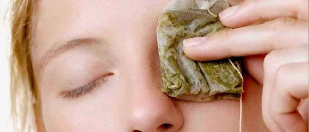 Arrugas en los p&aacute;rpados: c&oacute;mo prevenirlas y tratarlas