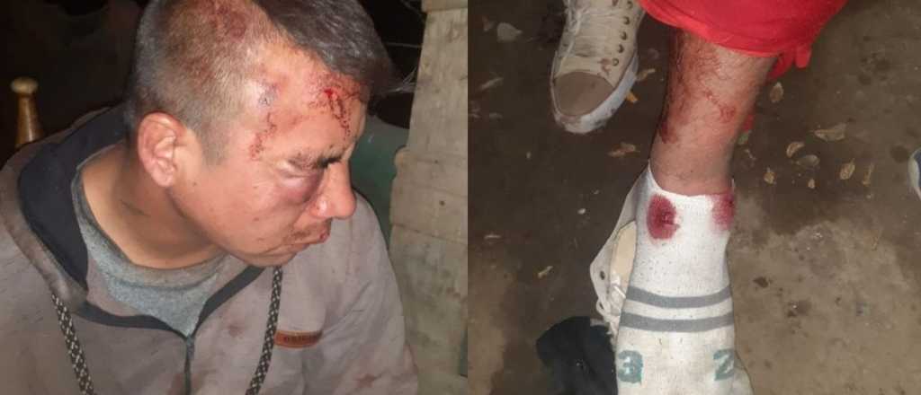Le "molieron" la cara a golpes y le dispararon para robarle en Tunuyán