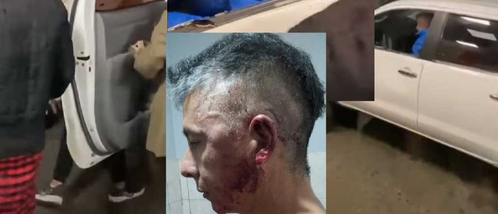 Pelea en el McDonald's de Palmares: "Podr&iacute;a haber terminado muerto ah&iacute;"