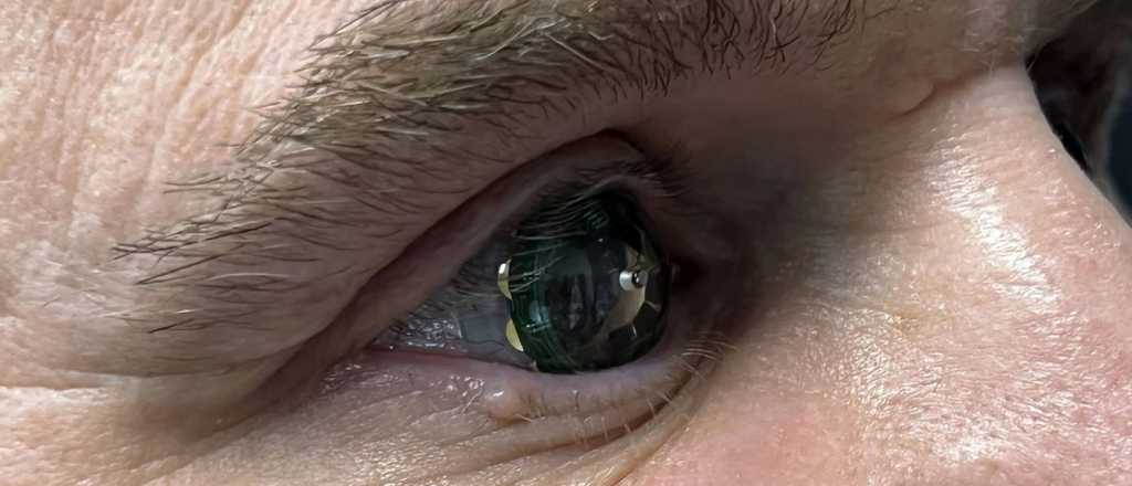 Cómo funciona el primer lente de contacto inteligente