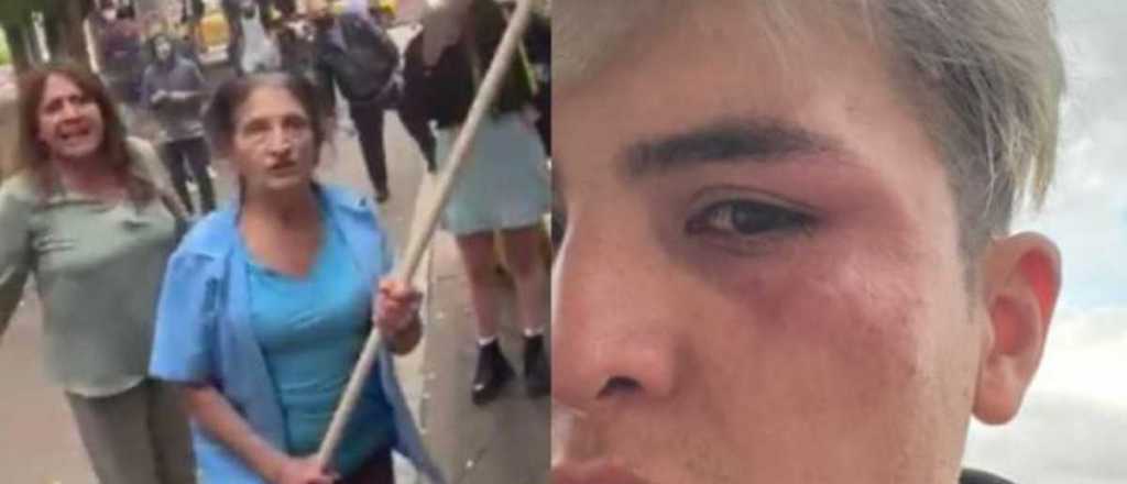 Video: mujeres atacaron con palos a una pareja gay que se besaba