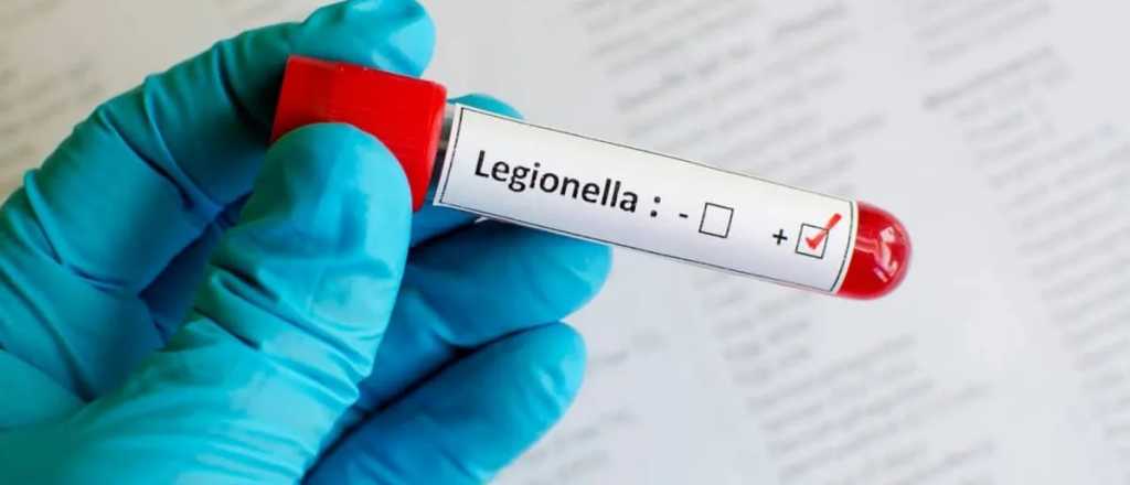 Legionella y Mendoza: estudian medidas de control