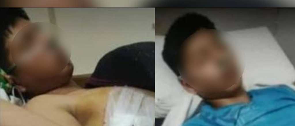 La familia de un joven dice que le perforaron el pulmón en una fiesta en Luján
