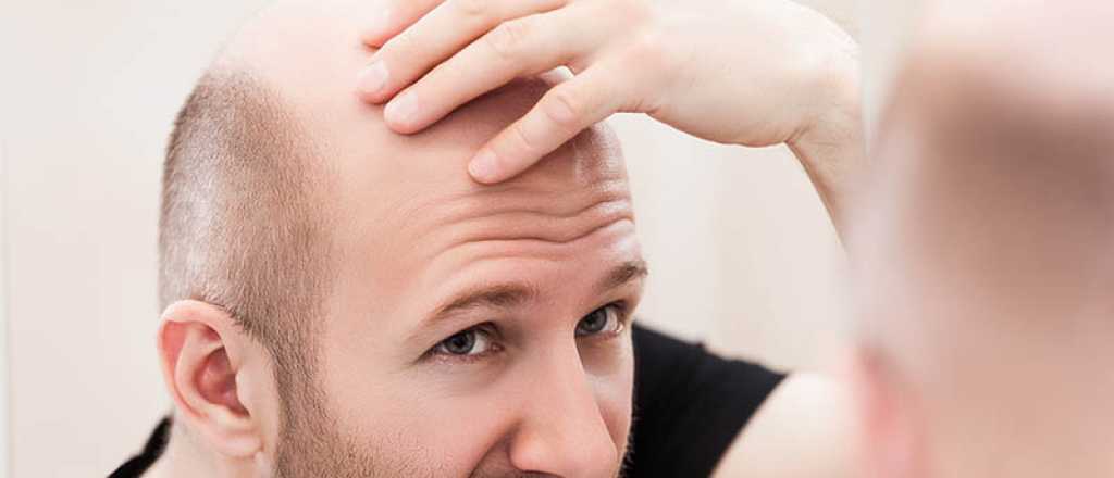 Adiós calvicie: un nuevo tratamiento para recuperar tu pelo