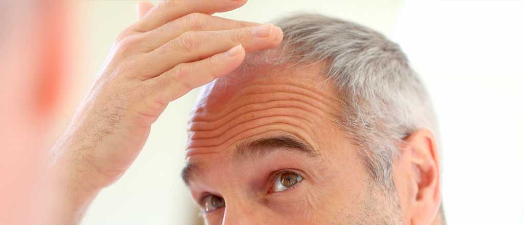Caída del cabello: causas, tratamientos y cómo prevenirla