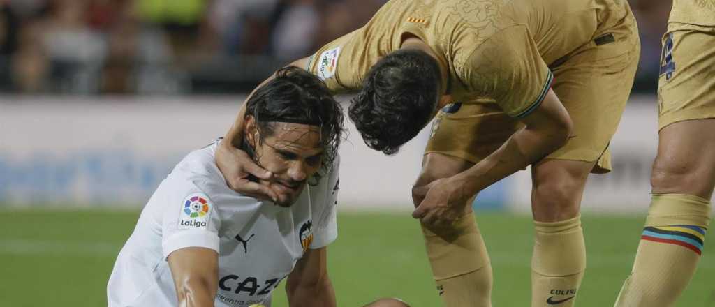 Bombazo en Uruguay: Cavani se lesion&oacute; a d&iacute;as del mundial