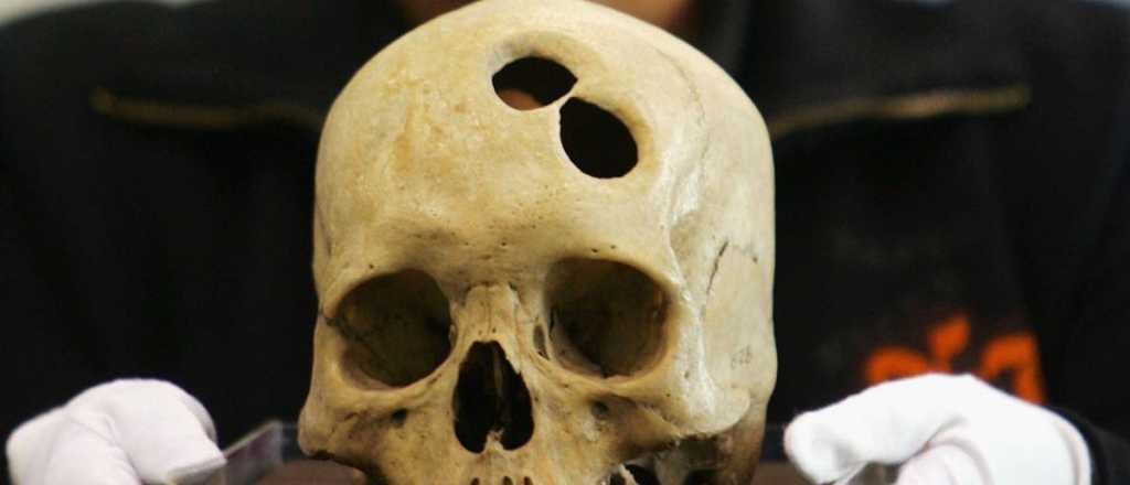 El cráneo que reveló el impresionante avance médico de los incas