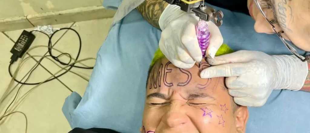 El influencer que se tatu&oacute; el nombre de Messi en la frente est&aacute; arrepentido