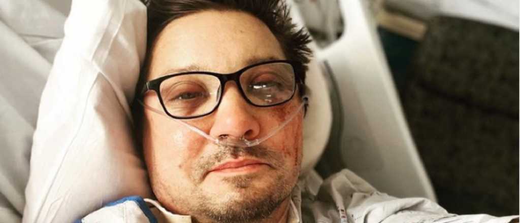 Con una selfie, Jeremy Renner envió un mensaje desde el hospital