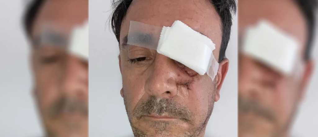 El limpiavidrios que desfiguró a un conductor en la Costanera irá preso 2 años