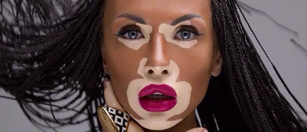 Las modelos "feas" que revolucionan las pasarelas del mundo