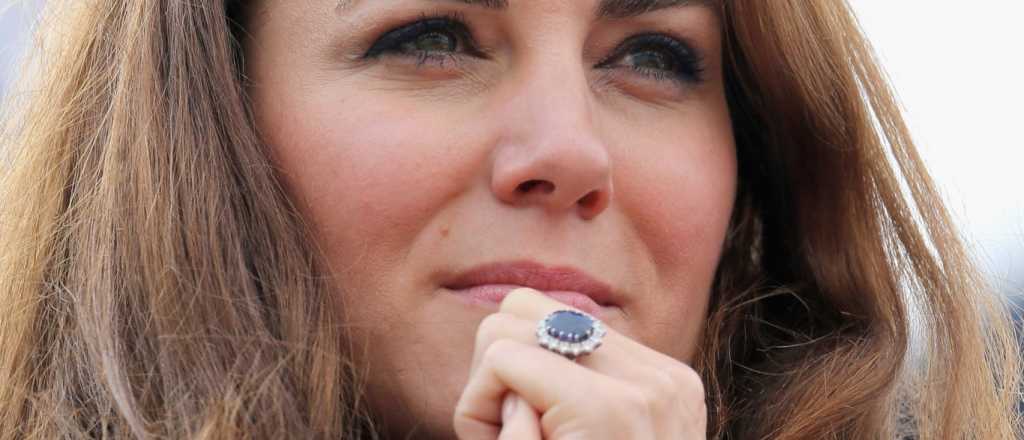 Cirug&iacute;a pl&aacute;stica "real": los antes y despu&eacute;s de la realeza