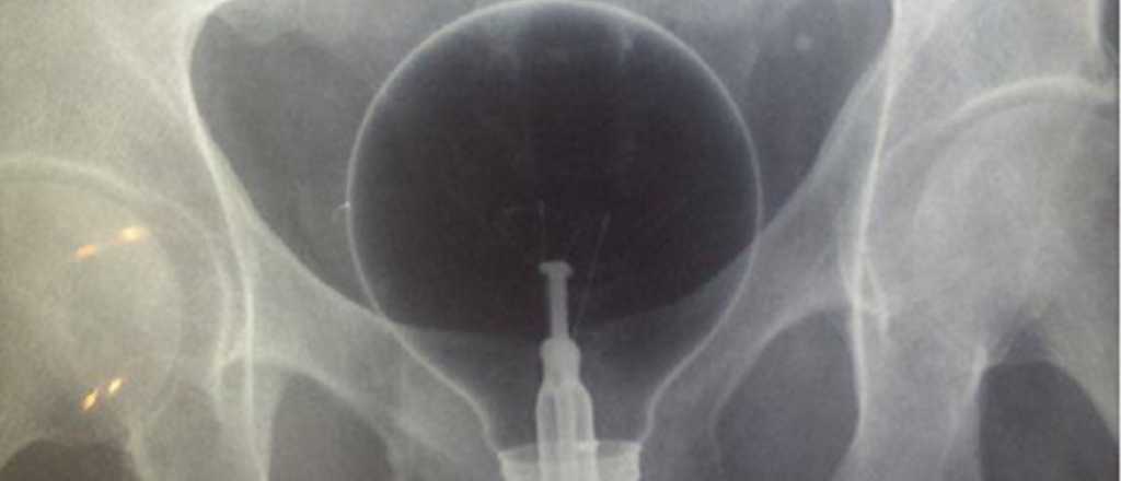 Estas son las radiograf&iacute;as m&aacute;s ins&oacute;litas del mundo